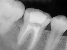 рентген зубов в москве