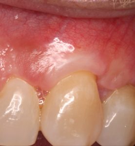 лечение зубов в москве